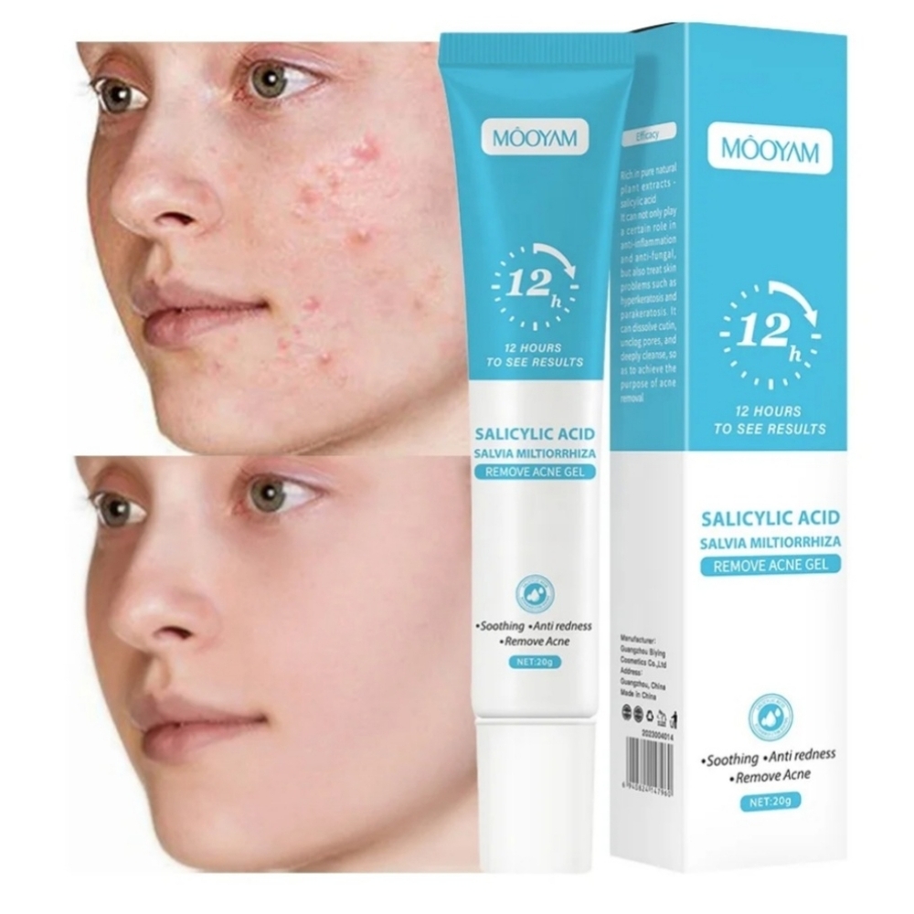 Salicylic Acid Acne Gel